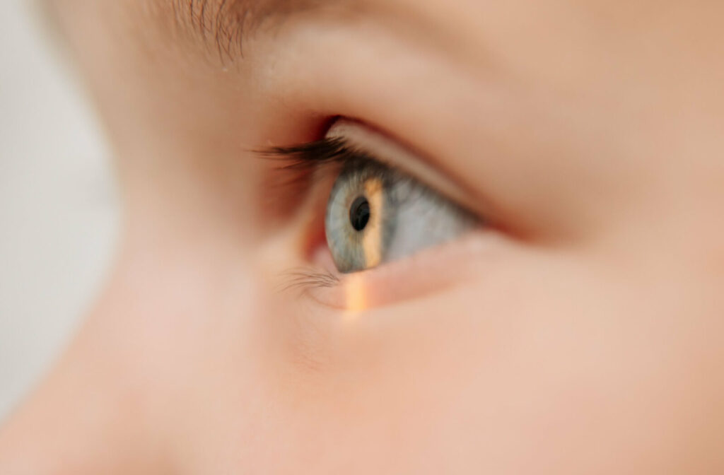 A close-up of a child's left eye while the light from a slit lamp shines over their blue eye during an eye exam